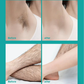 ⏰Limited-time offer!!🔥Painless Full Body Hair Removal Cream for Men & Women– Skin-friendly for all areas🌿